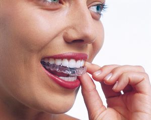 Klare herausnehmbare Invisalign Aligner, um die Zähne zu glätten | Swiss Smile  